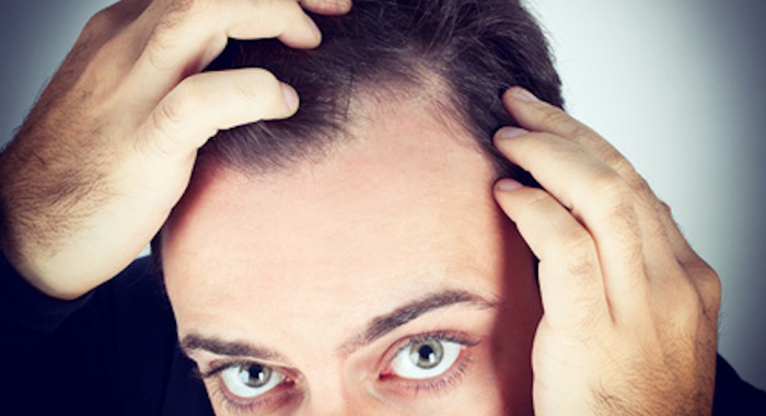 top-5-symptoms-of-dandruff